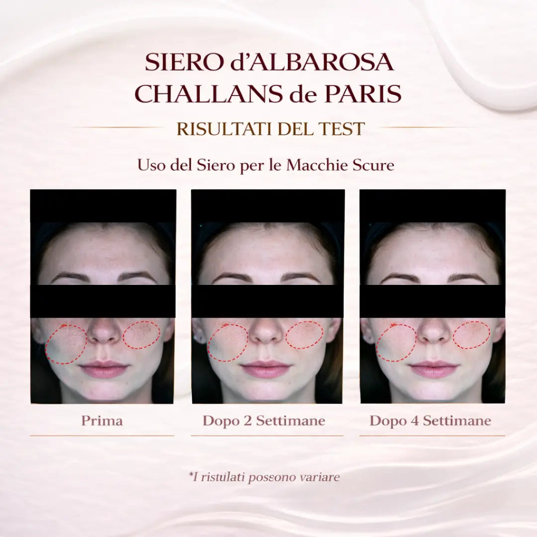 Ampoule d'Albarosa Excellence | Trattamento Intensivo Antimacchia e Depigmentante